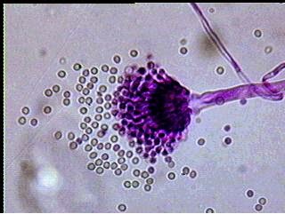 Aspergillus sp Aspergillus sp