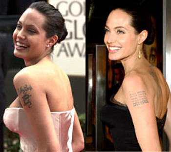 Remove Tatto on Tattoo Removal     A Safe And Effective Way To Remove Unwanted Tattoos