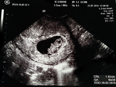 ultrasound of the new lil' scribbler