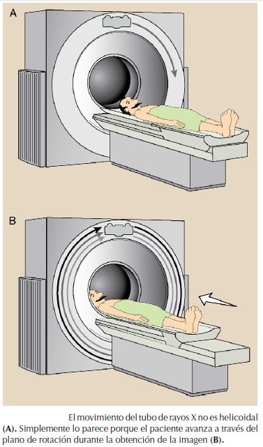 Figure 8 from Desentrañando la tecnología de la tomografía