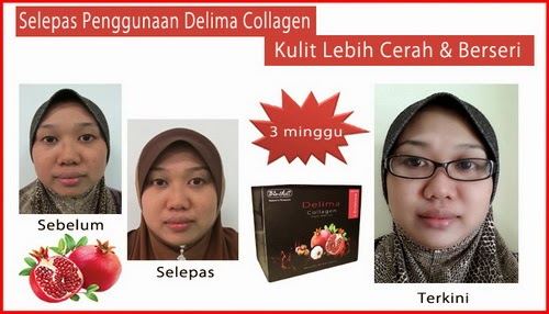 Delima Collagen