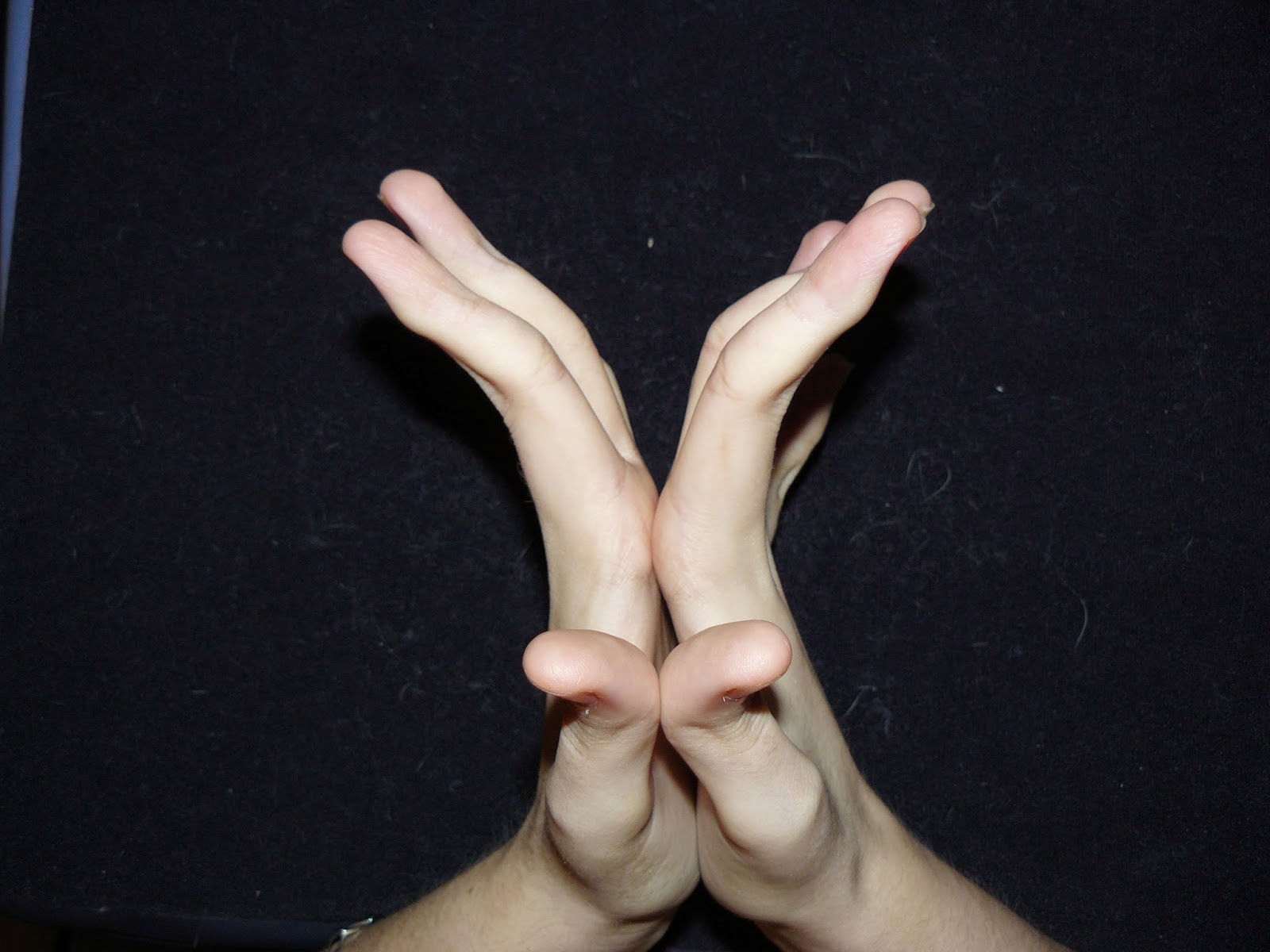 Lucy's Light: Ehlers-Danlos Syndrome: Are You Aware?
