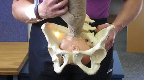 Bengkung Moden Terkini Sakit Di Tulang Ekor Coccydynia Selepas Melahirkan Anak