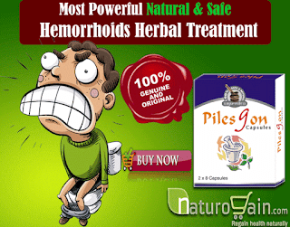 Treat Piles Or Hemorrhoids