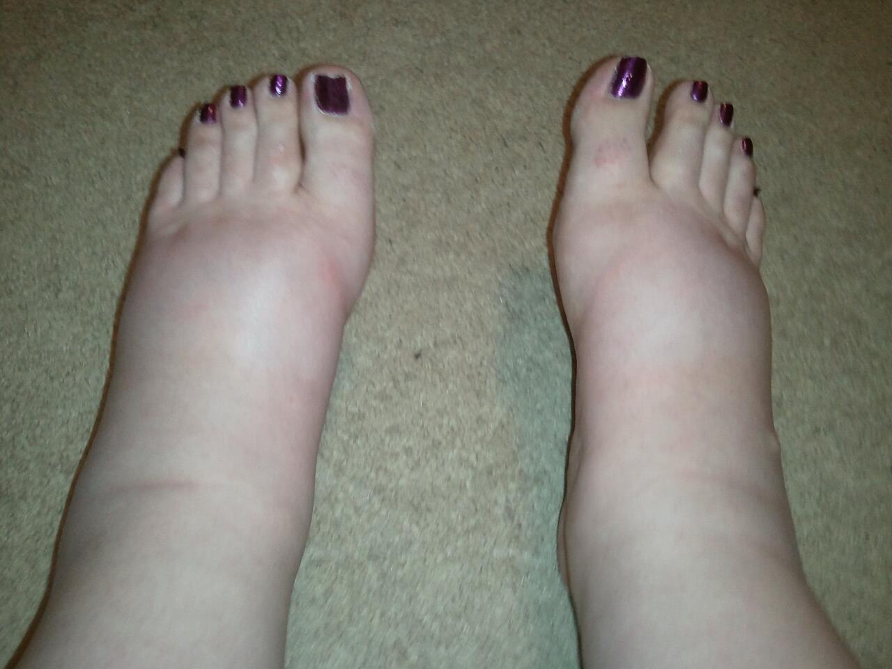 From Infertile to a Family... 40 Weeks, Due Date, Swollen Feet!