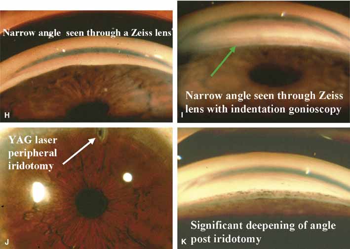 DOCZONE INTERESTING OPHTHALMOLOGY CLINICAL PHOTOGRAPHS