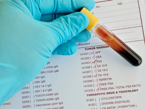 examen de sangre para detectar cancer cervicouterino