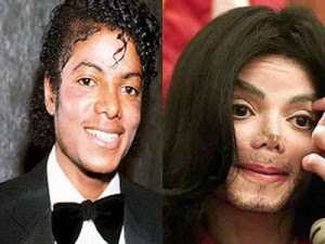 Michael Jackson Plastic Surgery on Michael Jackson Plastic Surgery 300x225 Jpg