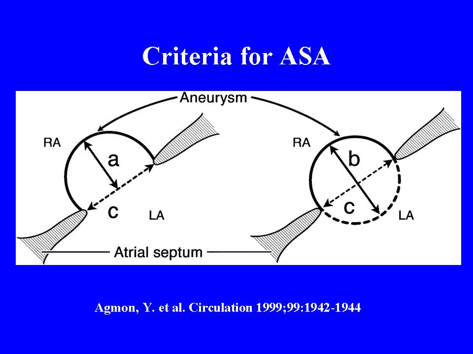 Pedi cardiology Echo ASD, TEE evaluation of rims for Transcatheter device closure