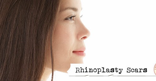 rhinoplasty scars eyelid surgery keloid