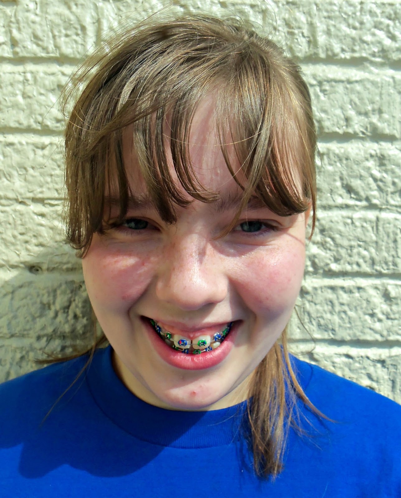 Sunshine Sentiments BRACES