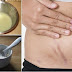 How to remove stretch marks with home remedies
