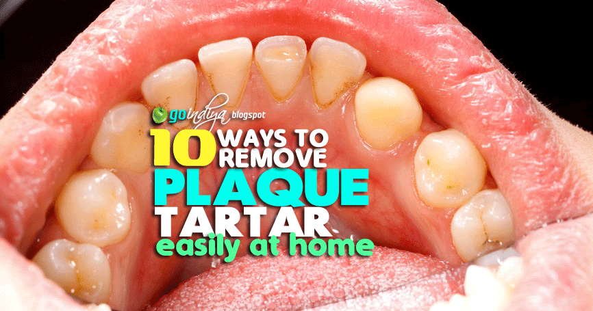 tartar removal 10 easy ways to remove plaque and tartar from teeth at home naturally home tartar removal 10 easy ways to remove plaque and tartar from teeth at home naturally home