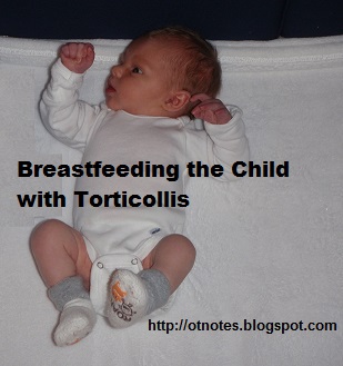 Nipple shield (breastfeeding) - Wikipedia