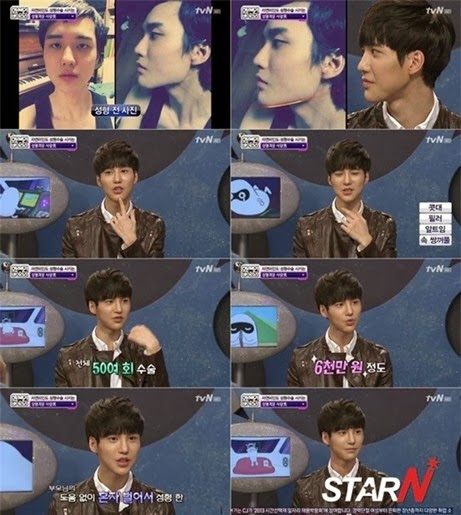 Phẫu thuật thẩm mỹ 50 lần để thành mỹ nam