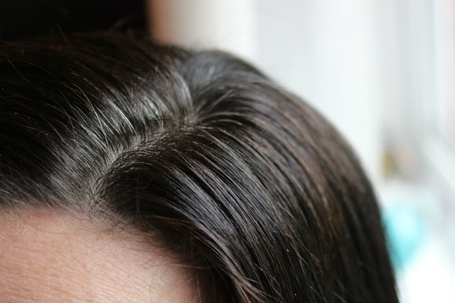 Henna Hair Dye Vitiligo Henna Hair Dye Vitiligo
