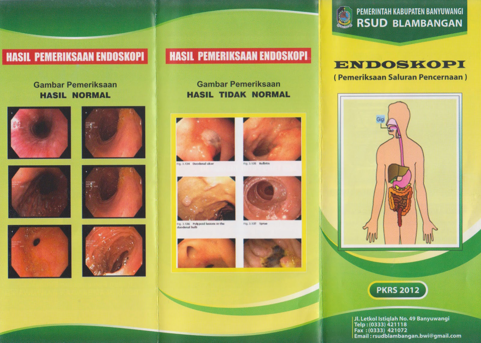 Endoskopi Contoh Brosur Promosi Kesehatan RS (PKRS) www