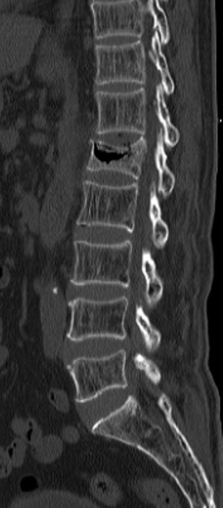 yochum and rowe essentials of skeletal radiology pdf