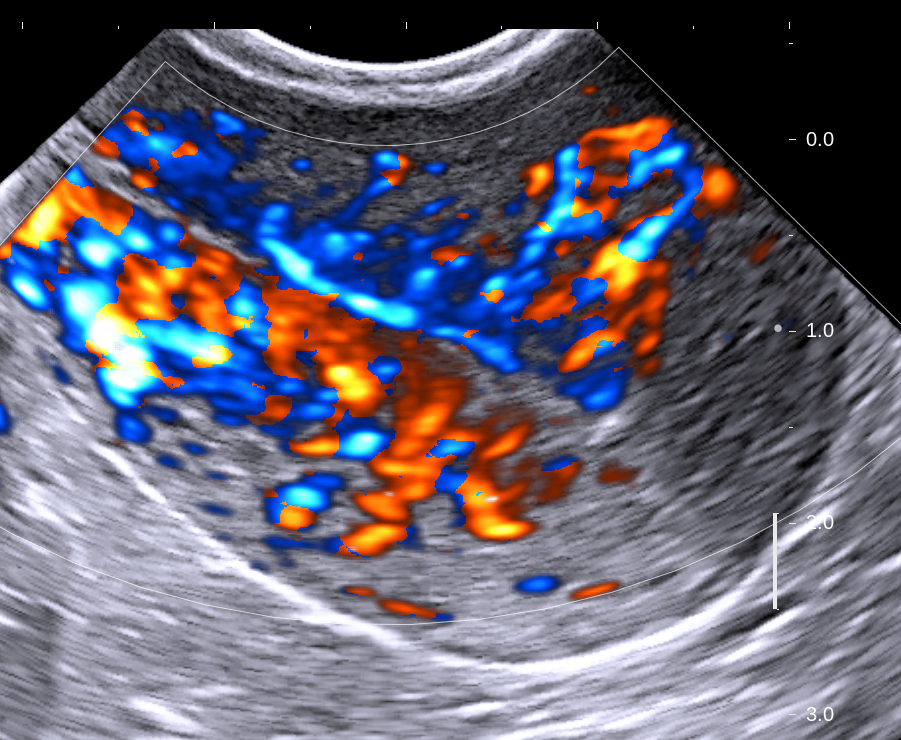 The Art of Ultrasound