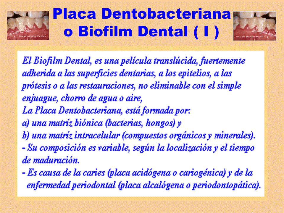 M13 BIOFILM DENTAL