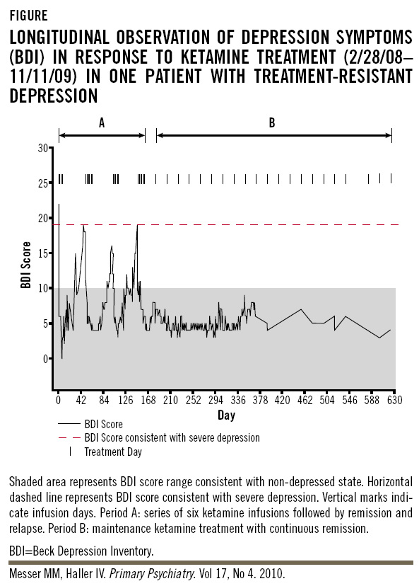 Ketamine Depression Research Trials
