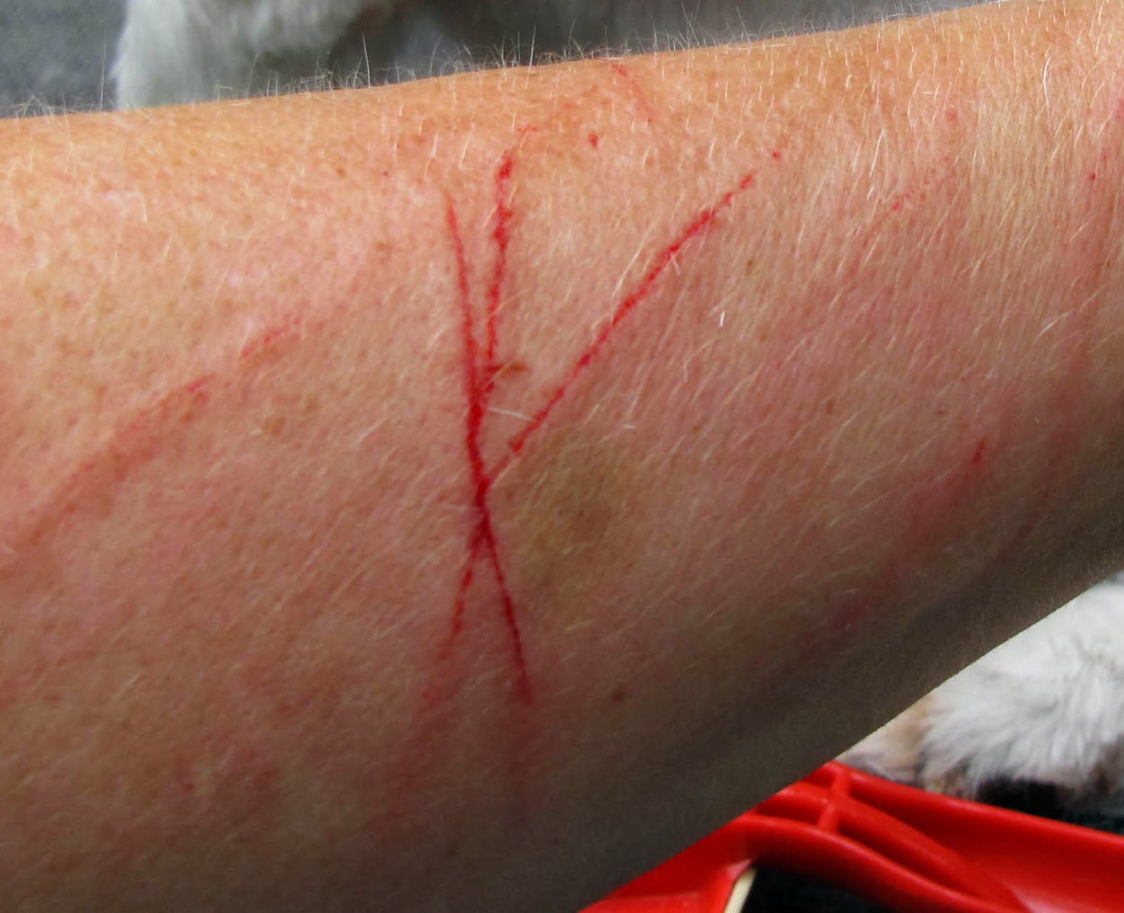 dog scratch on arm