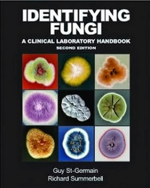 Identifying Fungi - A Clinical Laboratory Handbook -St-Germain