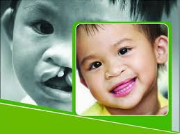 Proud Supporter of Operation Smile