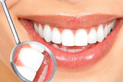 Cara Mencegah Gigi Berlubang
