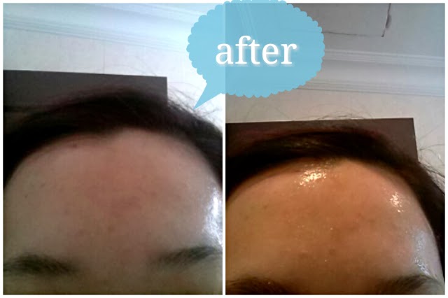 Download Share Care Review Beauty Clinic Mediheal Pomegranate Ade Mask PSD Mockup Templates