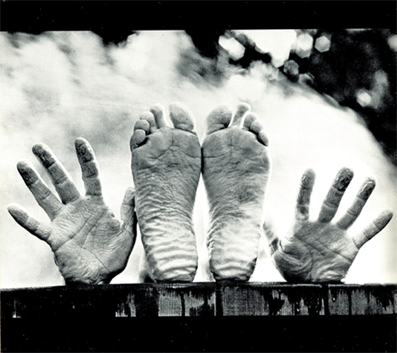 Collection 96+ Wallpaper Why Are My Fingertips Wrinkled Without Being