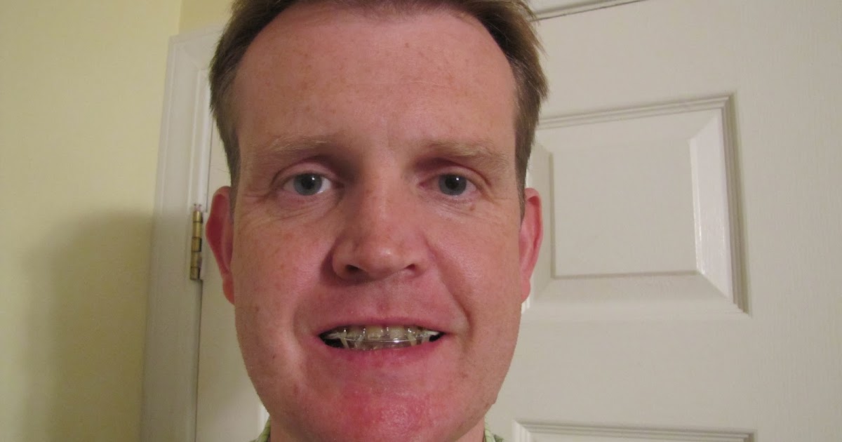 jaw brace double face