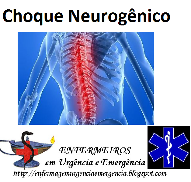 Enfermeiros em Urgência e Emergência Choque Neurogênico Cuidados de