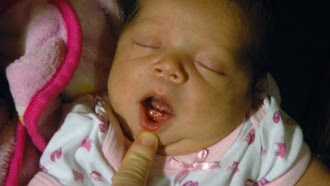 Nesa Lopez - Bayi Berumur Tiga Hari ini Sudah Tumbuh Gigi