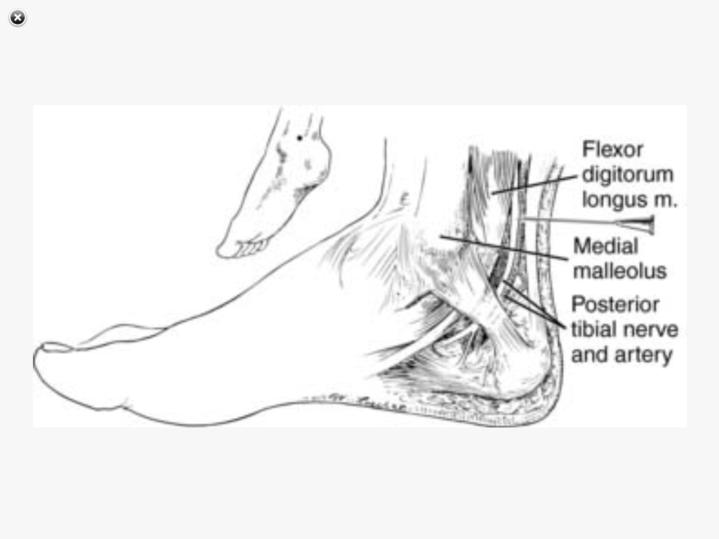 SRNA Daily Review REGIONAL ANESTHESIA BLOCKS
