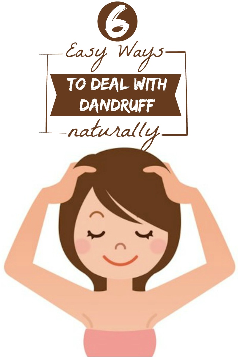 6 Easy Ways to Deal with Dandruff Naturally