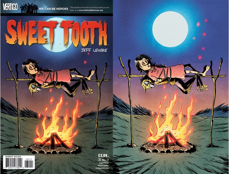 Tooth 31