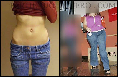 Normalidad, Obesidad y Anorexia: Una “montaña rusa” emocional. 1 ANOREXIA+Y+OBESIDAD foto 001