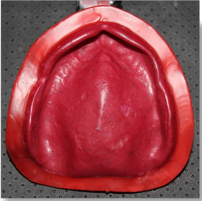 Step by step Guide for Understanding the Prosthodontics Complete