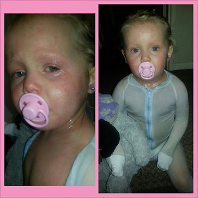 upset tearful bethanys eczema aggravated