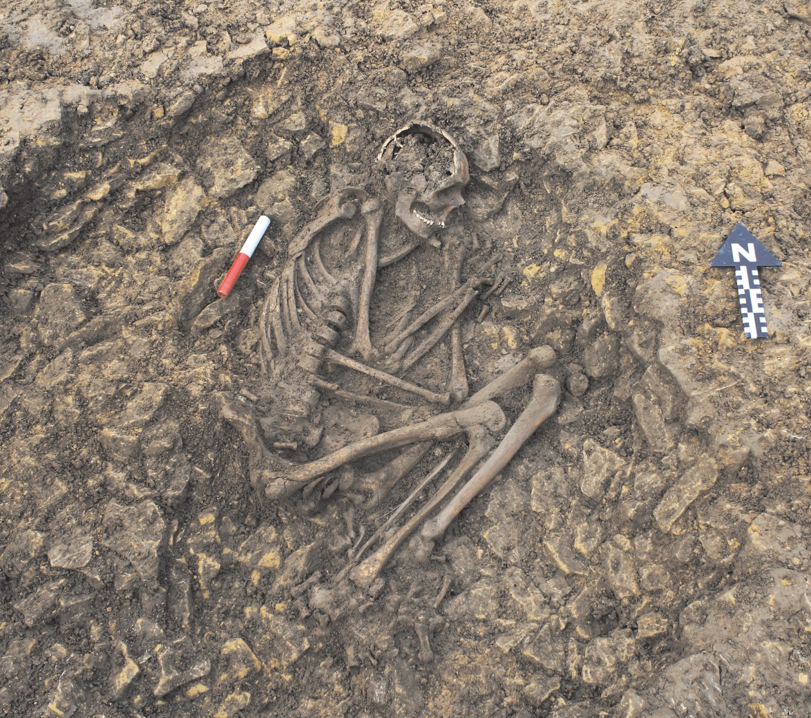 burial archaeology Vampires, criminals or slaves reinterpreting ‘deviant criminals or slaves reinterpreting ‘deviant burials’ in early essays in burial archaeology in. burial archaeology Vampires, criminals or slaves reinterpreting ‘deviant criminals or slaves reinterpreting ‘deviant burials’ in early essays in burial archaeology in.