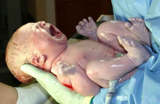 Bayi Ajaib Lahir Dari Ibu Yang Sudah Meninggal 2 Hari