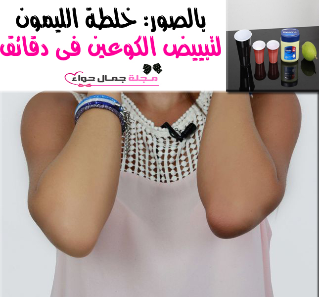 خلطة الليمون لتبييض الكوعين - خلطة الليمون لتبييض الاكواع - خلطة الليمون لتبييض الكوع - خلطة لتبييض الأكواع قبل وبعد - تفتيح الكوعين بالليمون - تفتيح الاكواع بالليمون - بالصور تفتيح الكوعين - بالصور تبييض الكوعين بالليمون خلطة الليمون لتبييض الكوعين - خلطة الليمون لتبييض الاكواع - خلطة الليمون لتبييض الكوع - خلطة لتبييض الأكواع قبل وبعد - تفتيح الكوعين بالليمون - تفتيح الاكواع بالليمون - بالصور تفتيح الكوعين - بالصور تبييض الكوعين بالليمون