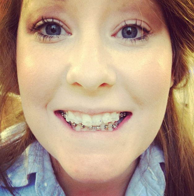 Mallory+Jeremy Wedding Braces.