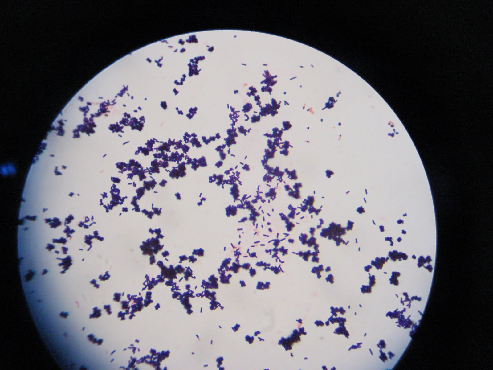 mixed bacteria