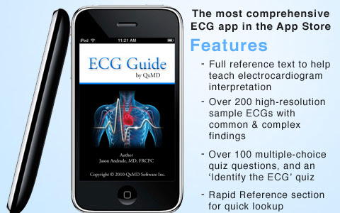 Hướng dẫn Toàn diện về ECG v4.4 cho iPhone