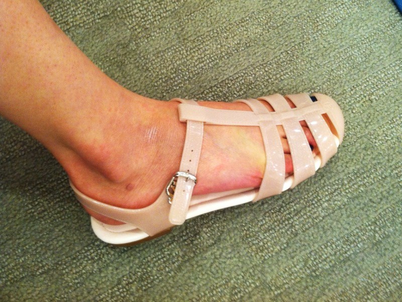 Chanel Jelly Sandals