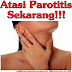 Cara Mengobati Parotitis Hingga Tuntas
