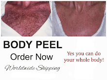 Body Peel