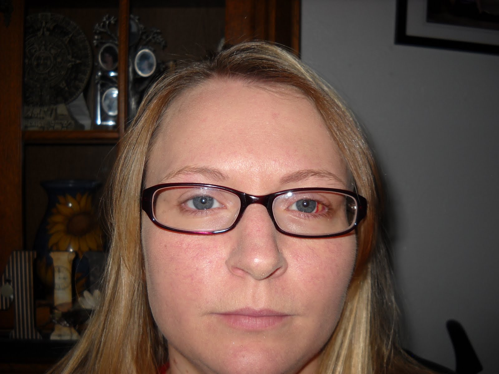 DigginbeingDoziers! The tale of the NOT so crooked eye!